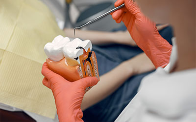 Современные альтернативы посеребрения зубов - Стоматология Линия Улыбки