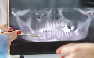 Имплантолог применяет МРТ для подробного изучения особенностей анатомии черепа - Стоматология Линия Улыбки