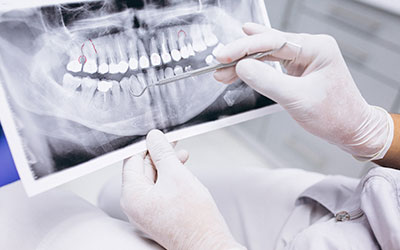 Чем занимается стоматолог-терапевт - Стоматология Линия Улыбки