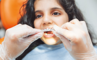 Выравнивание зубов с помощью накладок - Стоматология Линия Улыбки