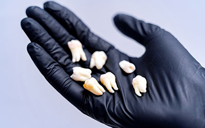 Какие виды имплантации зубов существуют - Стоматология Линия Улыбки