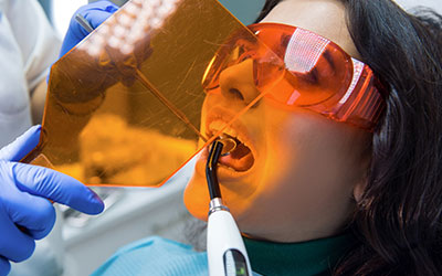 Лучшие пломбы для зубов - Стоматология Линия Улыбки