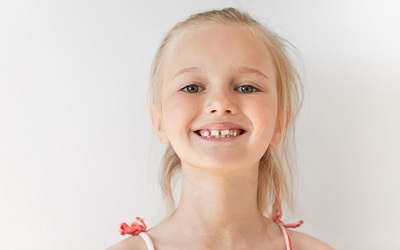 Неровные ряды зубов - Стоматология Линия Улыбки