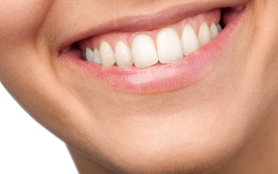 Стекловолоконные стоматологические конструкции позволяют восстановить естественную улыбку - Стоматология Линия Улыбки