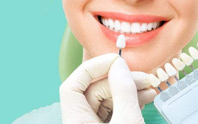 Замена утраченного зуба - Стоматология «Линия Улыбки»