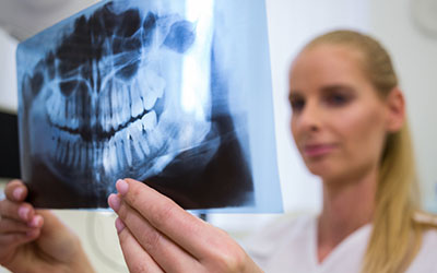 Сканирование зубов - Стоматология «Линия Улыбки»