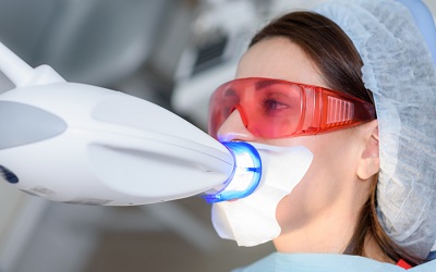 Чем отбеливать зубы — состав специальных стоматологических гелей - Стоматология Линия Улыбки
