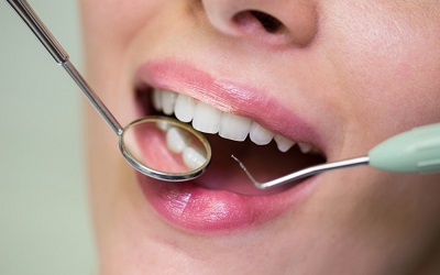 Как ускорить заживление десны после удаления зуба - Стоматология Линия Улыбки