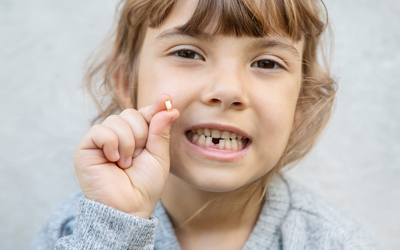 Как вырвать молочный зуб - Стоматология «Линия Улыбки»