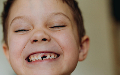 Какие молочные зубы выпадают первыми - Стоматология «Линия Улыбки»