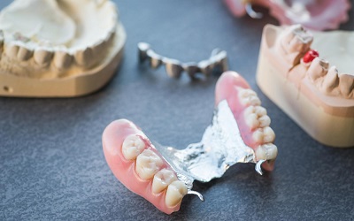 Конструкции зубных протезов - Стоматология Линия Улыбки
