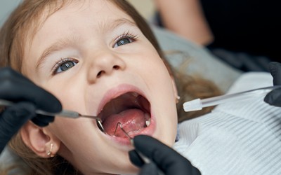 Лечить ли молочные зубы? - Стоматология «Линия Улыбки»