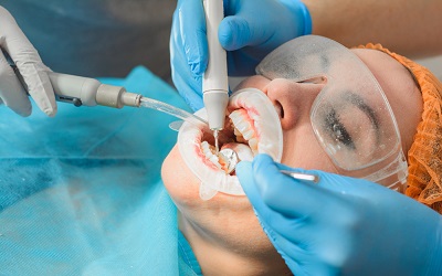 Операция на зуб - Стоматология Линия Улыбки