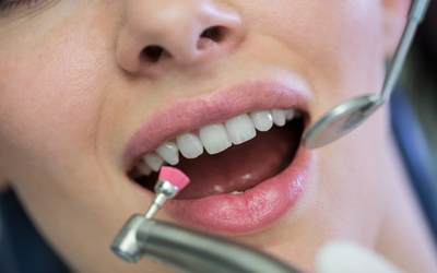Диагностика полости рта - Стоматология «Линия Улыбки»