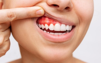 Показаниями к экстренному удалению зуба - Стоматология Линия Улыбки