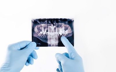 Проведение рентген-диагностики - Стоматология Линия Улыбки