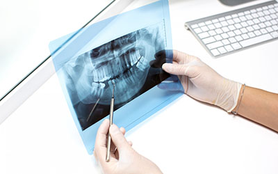 Рентген челюсти - Стоматология Линия Улыбки