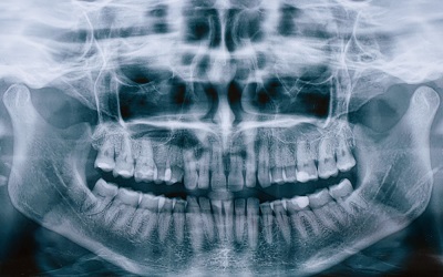 Рентгенография и ортопантомограмма - Стоматология Линия Улыбки