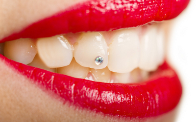 Стразы на зубы - Стоматология Линия Улыбки