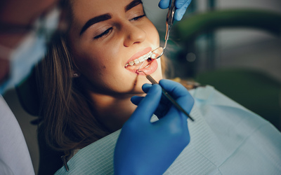 Ампутация корня зуба - Стоматология "Линия Улыбки"