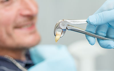 Удаление зубов мудрости - Стоматология «Линия Улыбки»