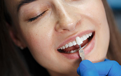 Методы восстановления разрушенных зубов - Стоматология «Линия Улыбки»