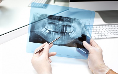 Выполнение снимков зубов - Стоматология Линия Улыбки